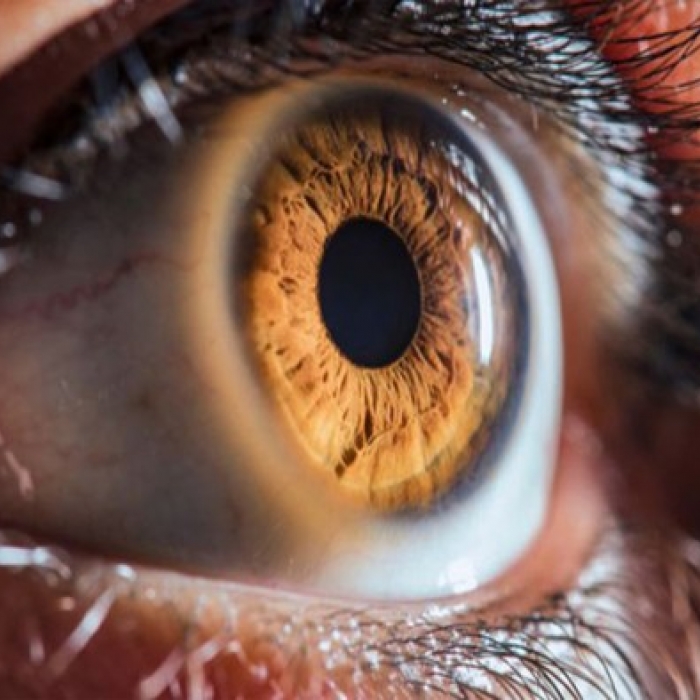 How Medical Cannabis can help with Macular Degeneration (MD)